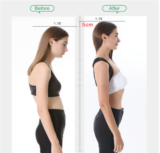 Before and after — gain 5cm of effective height with better posture